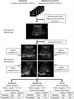 Deep Learning Assisted Detection of Abdominal Free Fluid in Morison's Pouch During Focused Assessment With Sonography in Trauma